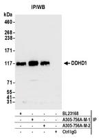 DDHD1 Antibody in Immunoprecipitation (IP)