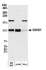 DDHD1 Antibody in Western Blot (WB)