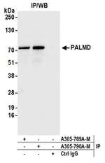 PALMD Polyclonal Antibody