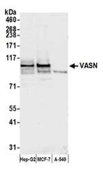 VASN Polyclonal Antibody