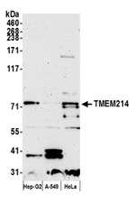 TMEM214 Polyclonal Antibody