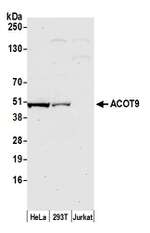 ACOT9 Polyclonal Antibody