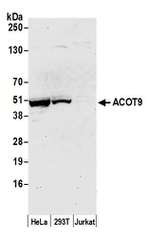 ACOT9 Polyclonal Antibody