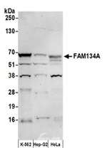 FAM134A Antibody in Western Blot (WB)