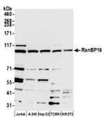 RanBP16 Polyclonal Antibody