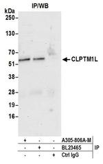 CLPTM1L Antibody in Immunoprecipitation (IP)