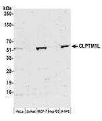 CLPTM1L Polyclonal Antibody