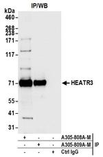 HEATR3 Antibody in Immunoprecipitation (IP)