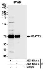HEATR3 Polyclonal Antibody