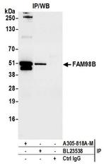 FAM98B Antibody in Immunoprecipitation (IP)
