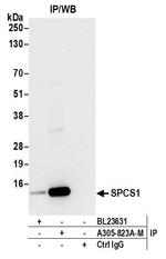 SPCS1 Antibody in Immunoprecipitation (IP)