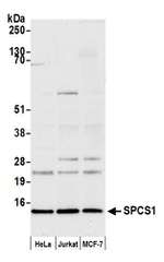 SPCS1 Polyclonal Antibody