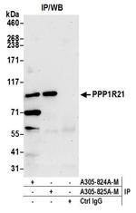 PPP1R21 Antibody in Immunoprecipitation (IP)