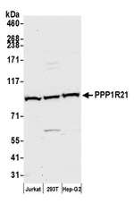 PPP1R21 Polyclonal Antibody