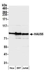 HAUS5 Polyclonal Antibody