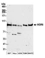 WDR6 Polyclonal Antibody