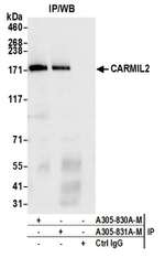 CARMIL2 Polyclonal Antibody