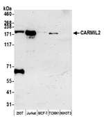 CARMIL2 Polyclonal Antibody