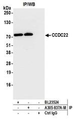 CCDC22 Antibody in Immunoprecipitation (IP)