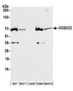 CCDC22 Polyclonal Antibody