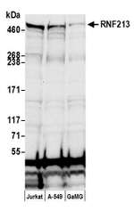 RNF213 Polyclonal Antibody