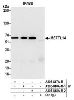 METTL14 Polyclonal Antibody