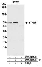 YTHDF1 Polyclonal Antibody
