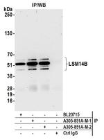 LSM14B Antibody in Immunoprecipitation (IP)