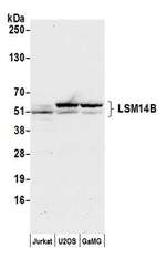 LSM14B Antibody in Western Blot (WB)