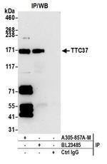TTC37 Antibody in Immunoprecipitation (IP)