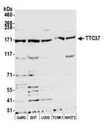 TTC37 Polyclonal Antibody