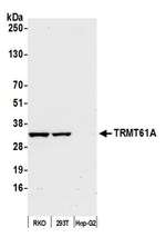 TRMT61A Polyclonal Antibody