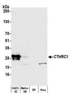 CTHRC1 Polyclonal Antibody