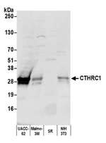 CTHRC1 Polyclonal Antibody