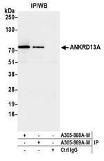 ANKRD13A Antibody in Immunoprecipitation (IP)