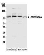 ANKRD13A Polyclonal Antibody
