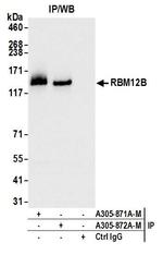 RBM12B Antibody in Immunoprecipitation (IP)