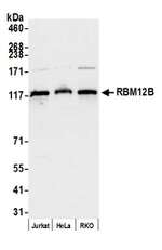 RBM12B Polyclonal Antibody
