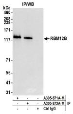 RBM12B Antibody in Immunoprecipitation (IP)