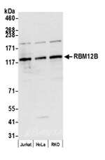 RBM12B Polyclonal Antibody