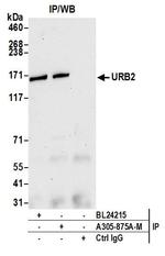 URB2 Antibody in Immunoprecipitation (IP)