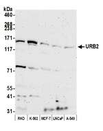 URB2 Polyclonal Antibody