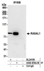 RASAL1 Antibody in Immunoprecipitation (IP)