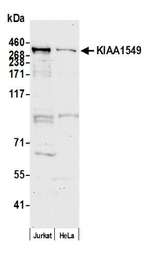 KIAA1549 Polyclonal Antibody