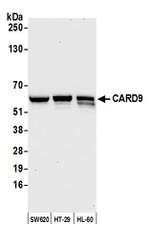 CARD9 Polyclonal Antibody