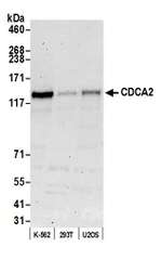 CDCA2 Polyclonal Antibody