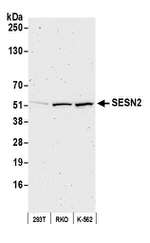 SESN2 Polyclonal Antibody