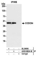 CCDC94 Antibody in Immunoprecipitation (IP)