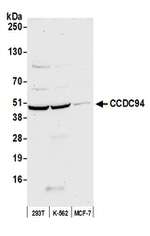 CCDC94 Polyclonal Antibody