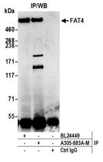 FAT4 Antibody in Immunoprecipitation (IP)